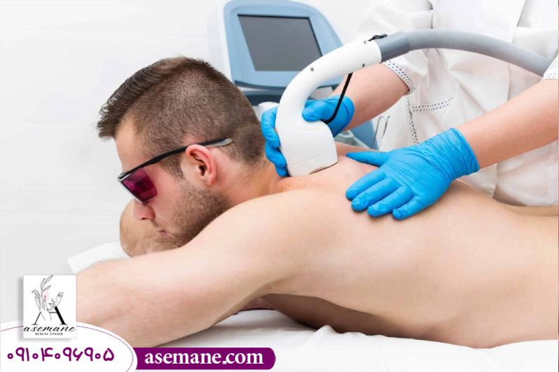 دلایل ممنوعیت لیزر موهای زائد 